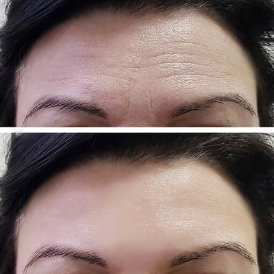 Before and after