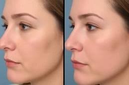Before and after