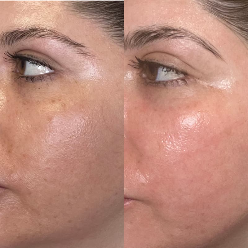 Before and after