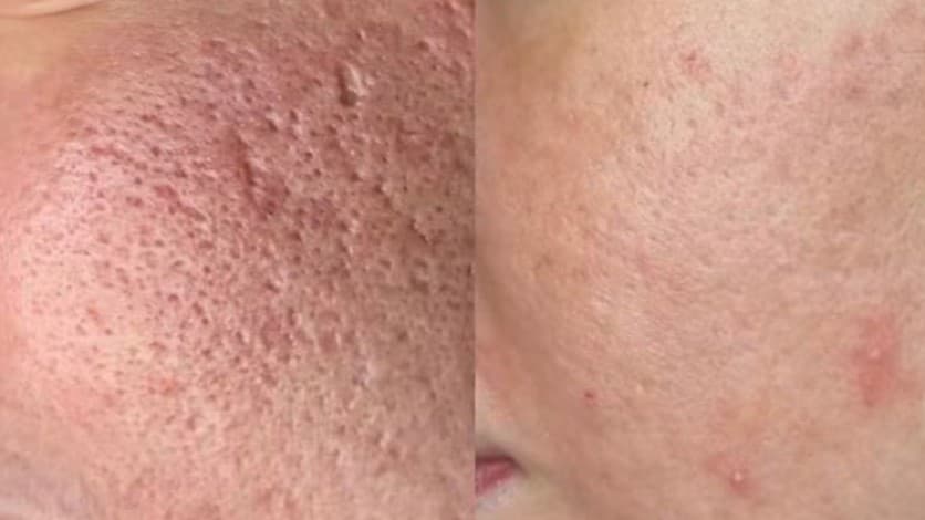 Before and after