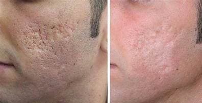 Before and after