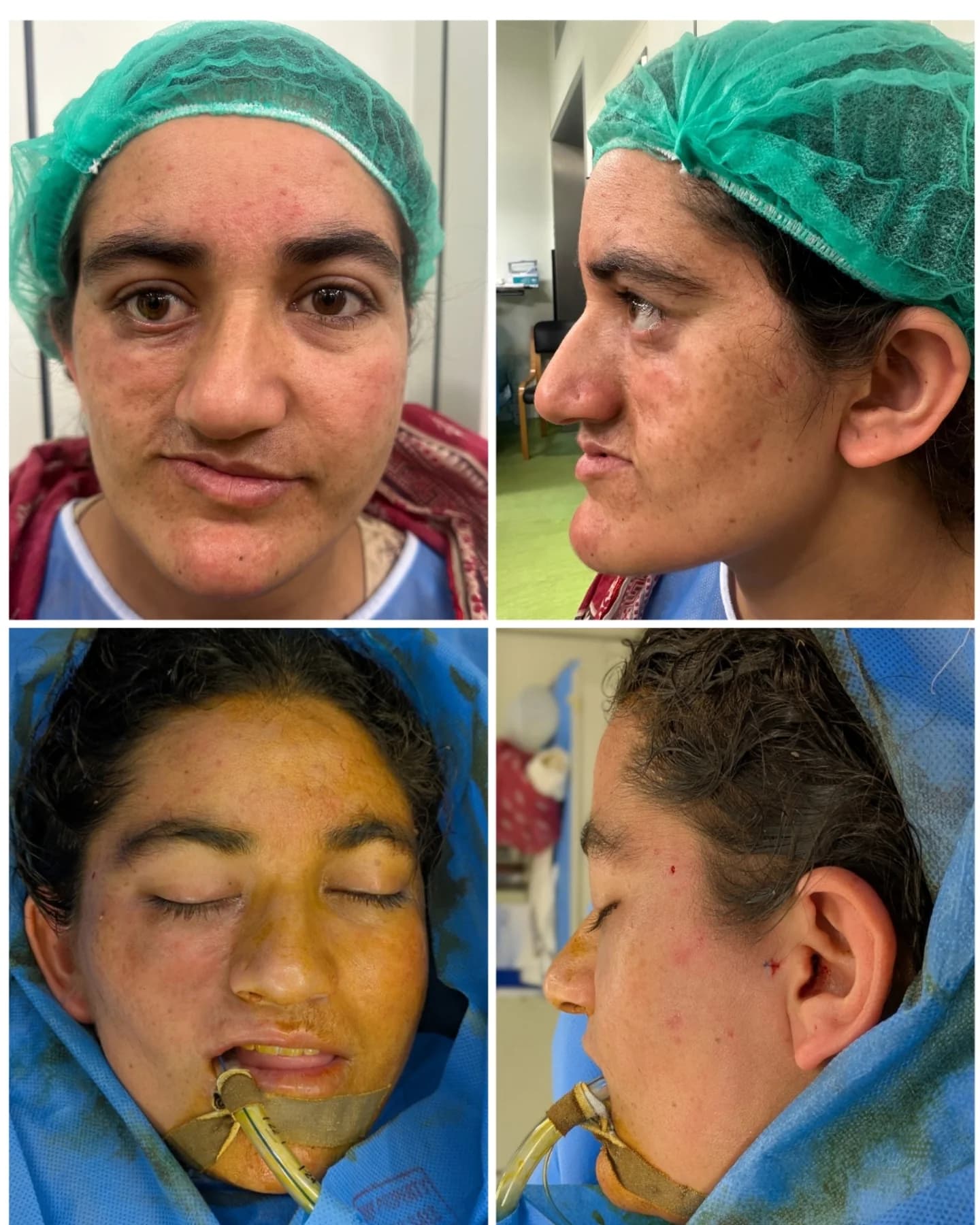 Before and after