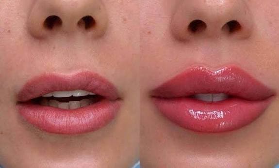 Before and after