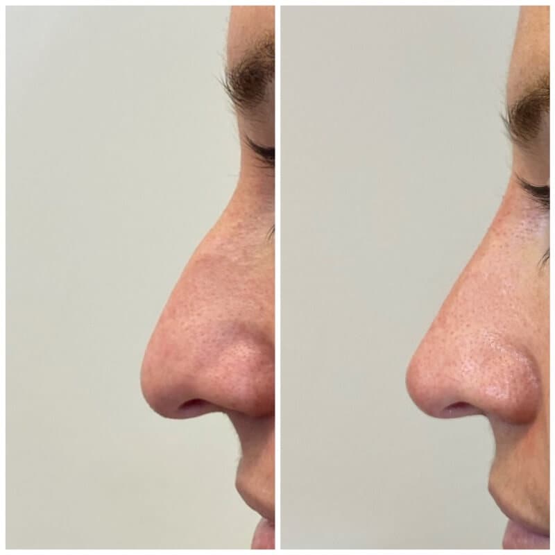 Before and after