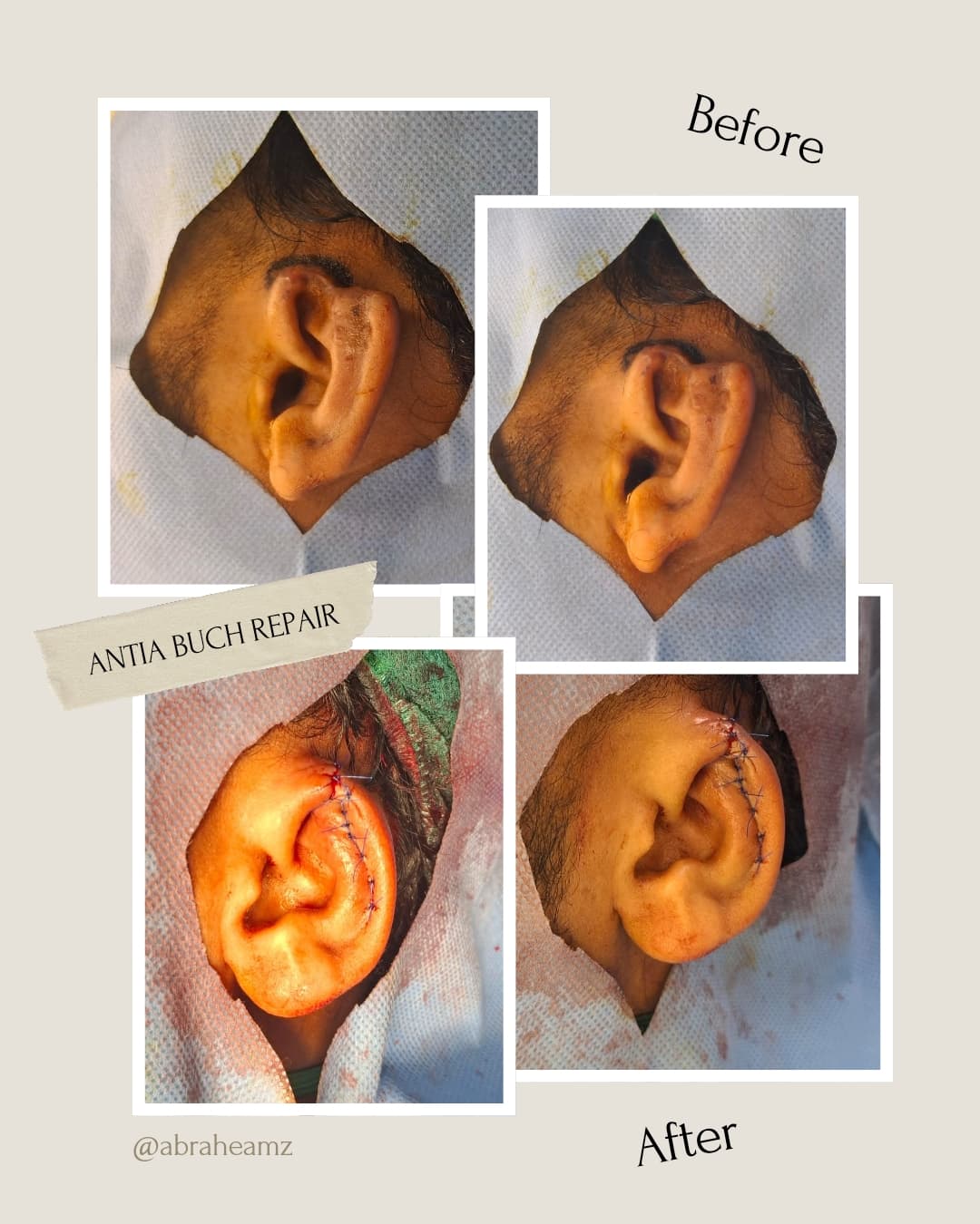 Before and after