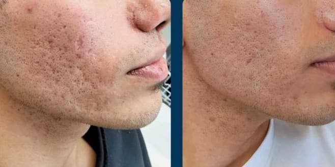 Before and after
