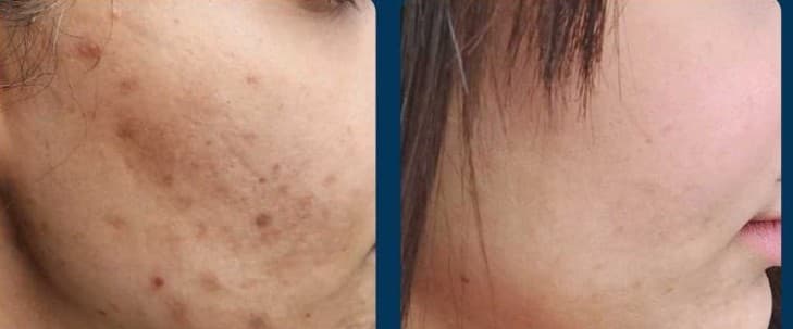 Before and after